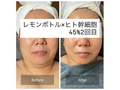 カノン(Kanon)の写真