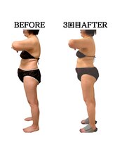 エミニー(EMINY)/後頭骨の際をぐっとゆるめます