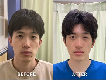 整音(totonone)の写真/【男性の食いしばり・頭痛にも】デスクワークによる首肩こり・眼精疲労・顔のむくみを根本からケア。