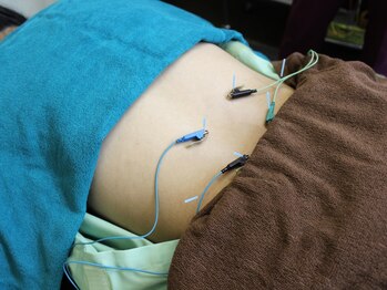 いなほ はりきゅう整骨院 東新宿/鍼灸(吸い玉併用)コース