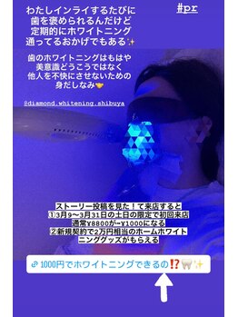 ダイヤモンドビューティー(DIAMOND BEAUTY)/人気インフルエンサーご来店