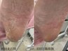 本格足裏つるつる角質ケア