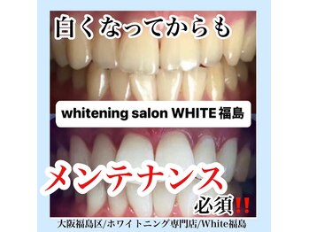 ホワイトニングサロン ホワイト(WHITE)/セルフホワイトニング/大阪/福島