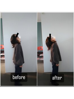 イトウ カイロプラクティックパートナー(ITOU)/Before &After