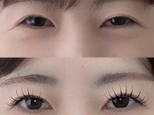 シャール(shall)/エクパ/LED/マツエク/エクステ