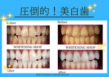 ホワイトニングショップ 府中店