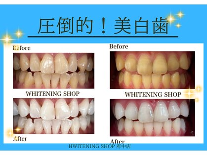 ホワイトニングショップ 府中店の写真