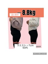 ヴェリテ(Verite)/before after