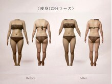 ベルミナ(Belmina)/大名/天神/毛穴/脱毛/痩身