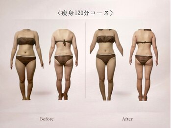 ベルミナ(Belmina)/大名/天神/毛穴/脱毛/痩身