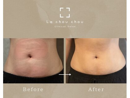 ラシュシュ モイ(moi)の写真