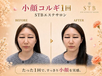 STBエステサロンの写真