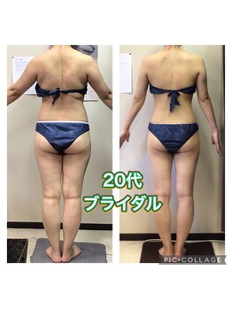 美ボディラボ(美Body Labo)/20代ブライダル