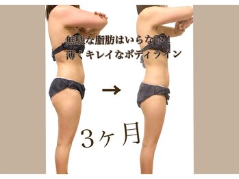 ウェリナポノビューティサロン(welina pono beauty salon)/《痩身/ダイエット/小顔》
