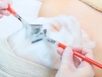 ジャミングレブ 六本木(jammmingrev)の写真/【大人気！韓国肌管理】超お得《ララピール》剥離・ダウンタイムなし！お肌を育てるピーリング