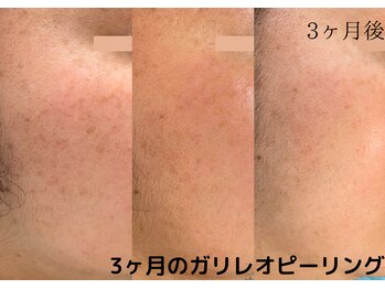 フロート(float)/