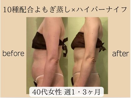 サロンハート(Salon Heart)の写真