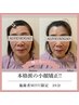 ◆小顔矯正◆ カウンセリングから施術まで!!　通常￥12,800→￥4,500