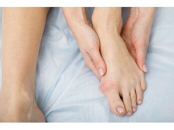 つばき接骨院/外反/母趾改善も行っています！