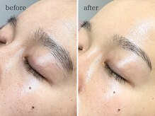 エリー(Ellie)/下がり眉も整えれば改善されます