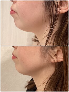 フォーユー 飯能店(Foryou)/レモンボトル効果すごいです!