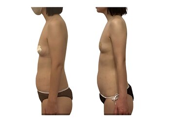 ベンザイ 新潟店(BENZAI)/体幹のブレ、慢性肩こり