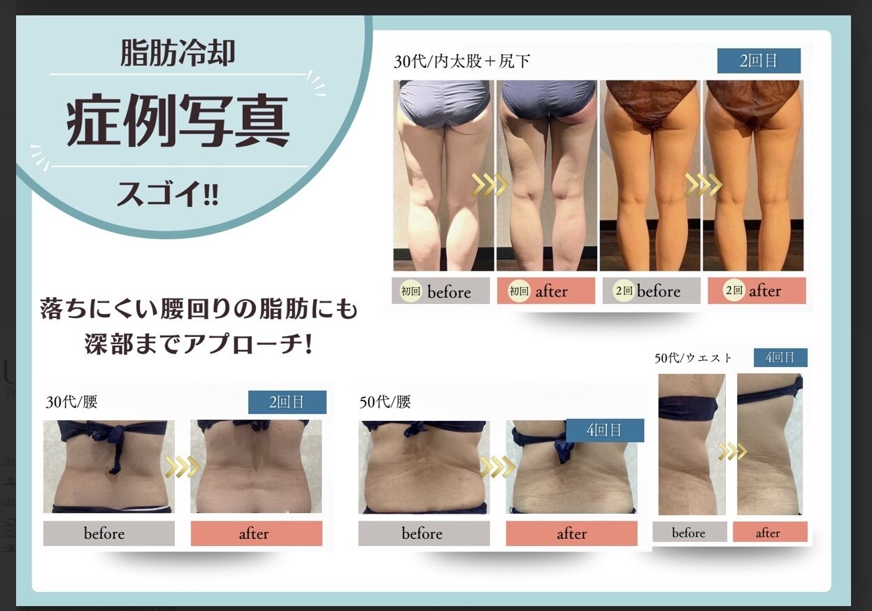 ケアビューティーソラ(care beauty SORA)｜ホットペッパービューティー