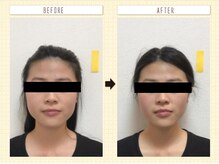 コロナ整体 神宮前院(Corona.整体)/小顔 Before&After〈原宿/小顔〉