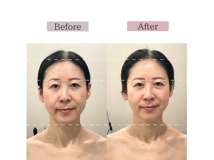 フロリール アザブジュウバン(FlorirAzabujuban)の写真