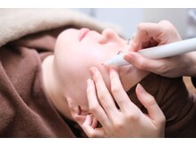 ホワラ 横浜店(Whila)の雰囲気（低周波で光施術では難しい目の周も！ピンポイントでアプローチ★）