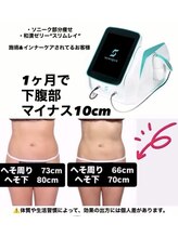 カシェット(cachette)/ソニークで最短で引き締め