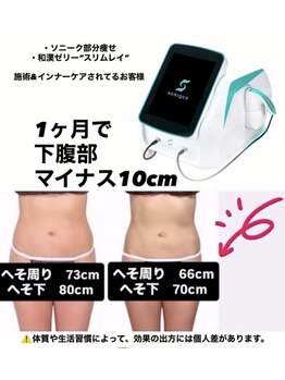 カシェット(cachette)/ソニークで最短で引き締め