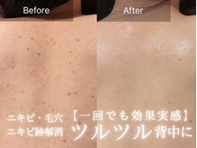 フォーウーマン(for woman)