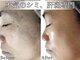 ルノン(LUNON)の写真/シミ、シワを改善しながら未来の肌まで美しく整える本格ケア