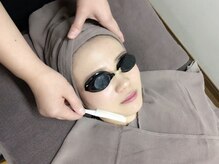 アルファイン 松本本店/フェイス脱毛