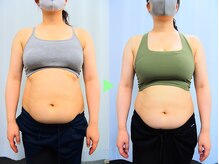 はたらくからだ研究所/【整体×痩身エステ】ダイエット