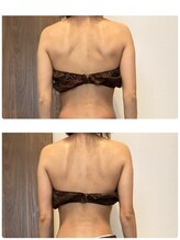 ピュア(Pure)/オールハンド筋膜リリース