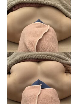 レナブルーム(Renabloom)/綺麗なバストに