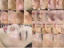 レシェルサロン(Lechelle Salon)の雰囲気（長年の肌悩みも数カ月で改善できた人95％以上）