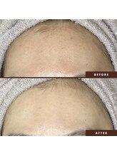 ネリネ(Nerine)/徹底毛穴レスフェイシャル