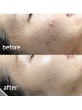 エヌエー(Na)/フェイシャル リゼネレート