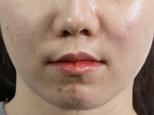 GRACETHOUSAND(グレイスサウザンド)/【韓国肌管理】ララピール