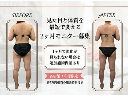 ラヴィニティ 池袋店(Lavinity)の写真