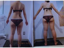 パーフェクトボディプレミアム 札幌大通店(PERFECT BODY PREMIUM)/お客様　ビフォーアフター（17）