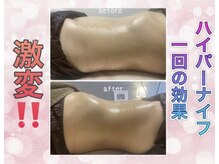 美容整体ウェリナ 名駅院/小顔矯正/骨盤矯正/美脚サロン