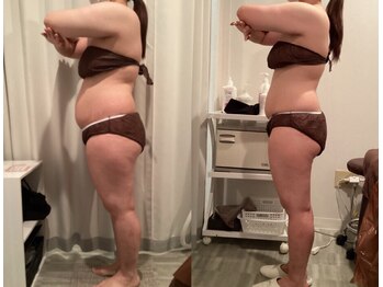 アネル 新都心店(anel)/痩身　ダイエット　《那覇》