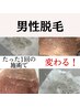 ↓【男性脱毛メニュー】↓