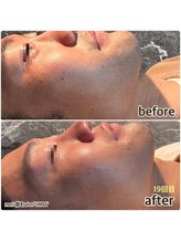 シンバ 倉敷店(SIMBA)/