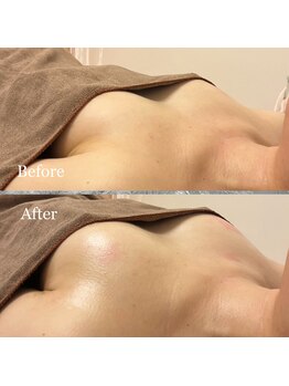 プリマベラ 大阪梅田(primabella)/ハリ、ツヤ、弾力♪