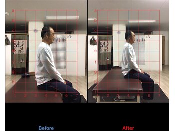 ストレチックス 近江八幡店/BeforeAfter